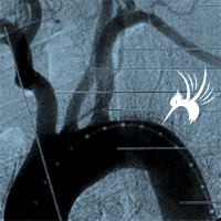 颈动脉的正常变异影像学图片